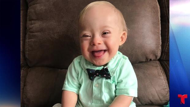 [TLMD - NATL] Viral: el primer “bebé Gerber” con síndrome de Down