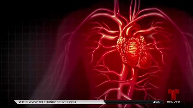 Lo que debes saber para prevenir ataque al corazón