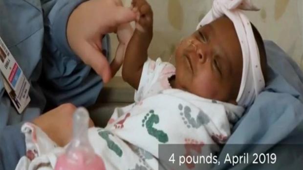 [TLMD - SD] En video: la bebé más pequeña del mundo nació en San Diego, California