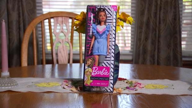 [TLMD - NATL] La viral acción que desencadenó la Barbie con prótesis