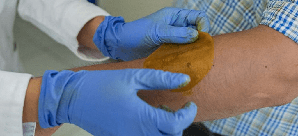 Crean científicos de la UNAM parche que regenera la piel en diabéticos