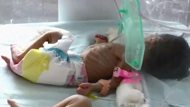 Desgarrador: hallan a recién nacida enterrada viva