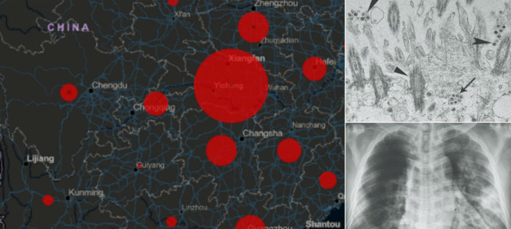 Mapa: en tiempo real, contagios y víctimas del coronavirus