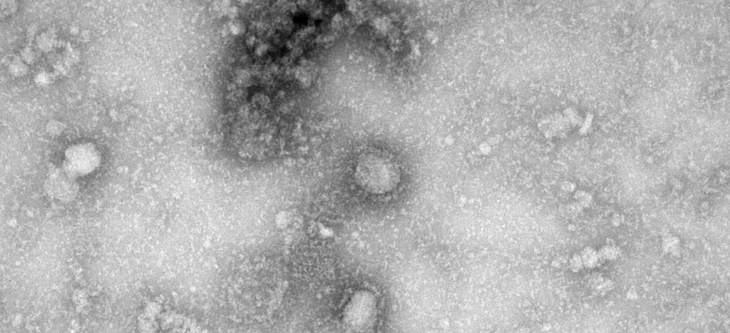 Ya son 106 los muertos por coronavirus; Alemania confirma su primer caso