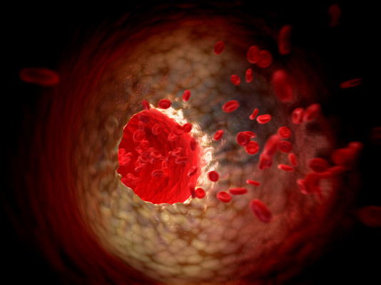 Karius recauda $ 165 millones para su tecnología de biopsia líquida que identifica enfermedades con extracción de sangre