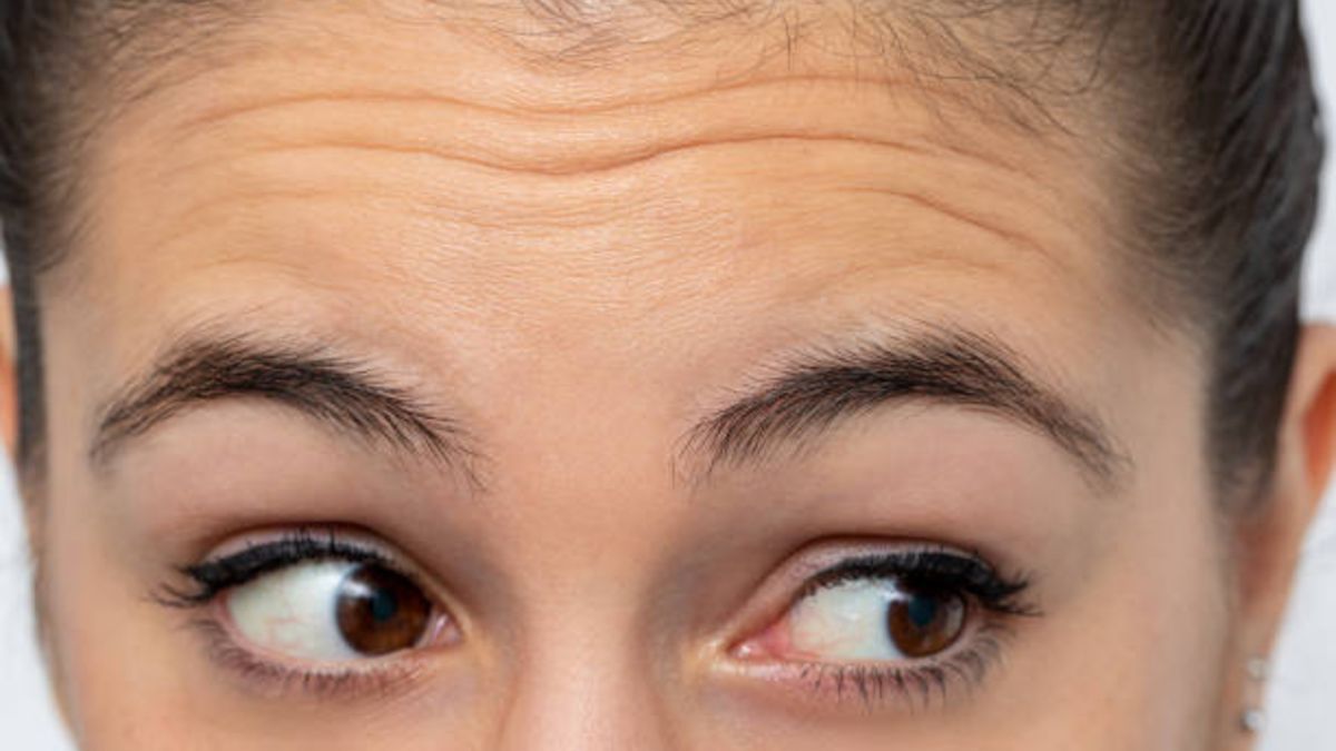 Tips para poder eliminar las arrugas en la frente de forma eficaz