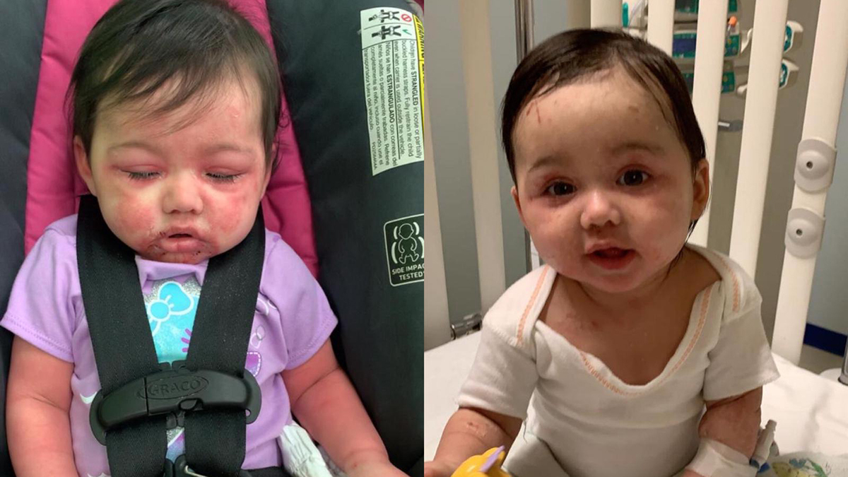 Luchando por su vida: bebé de seis meses da positivo a COVID-19