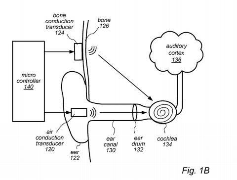 un esquema de la patente de Apple que muestra cómo se vería un dispositivo auditivo de conducción ósea