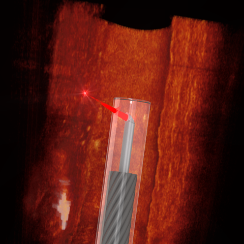 endoscopio ultrafino impreso en 3d que toma imágenes de una arteria