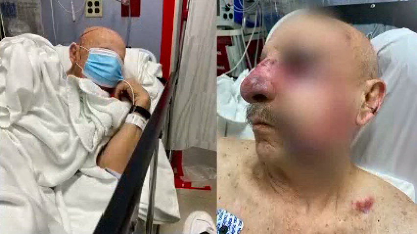 “No sé cómo salió con vida”: anciano sufre violento ataque en un tren