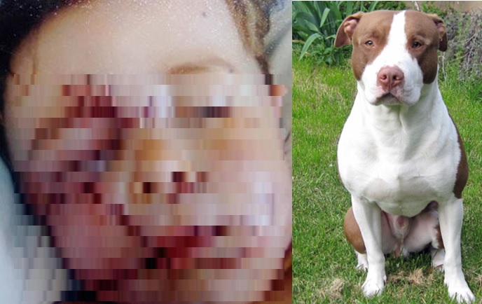 Un niño es atacado por un perro, le desfigura el rostro, requiere cirugía reconstructiva