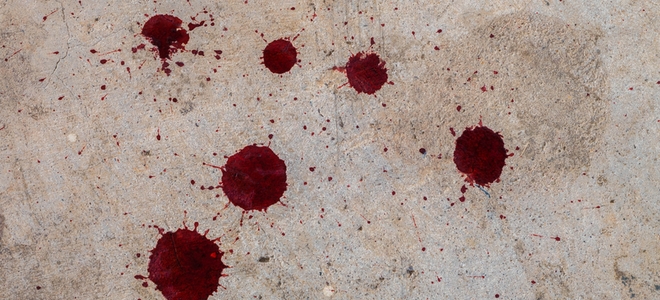 Cómo quitar las manchas de sangre de las superficies de cemento