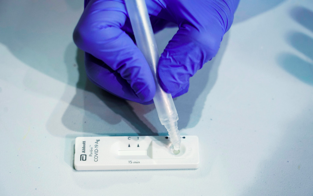 UE recomienda uso de tests rápidos de Covid tras aparición de síntomas