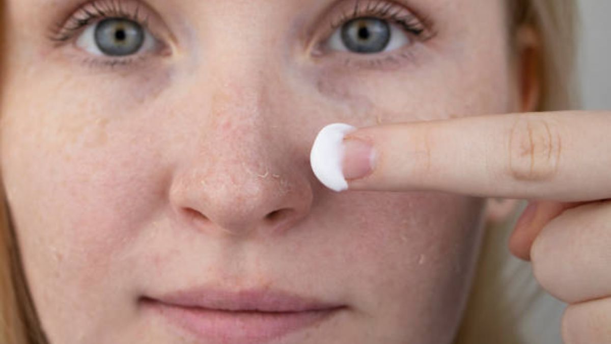 Maquillaje para la dermatitis atópica: cómo hacerlo