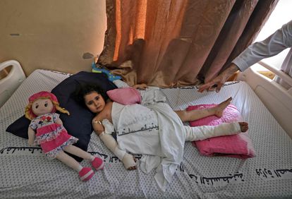 Una niña palestina herida en un bombardeo israelí, el día 19 en el hospital Shifa de Gaza.