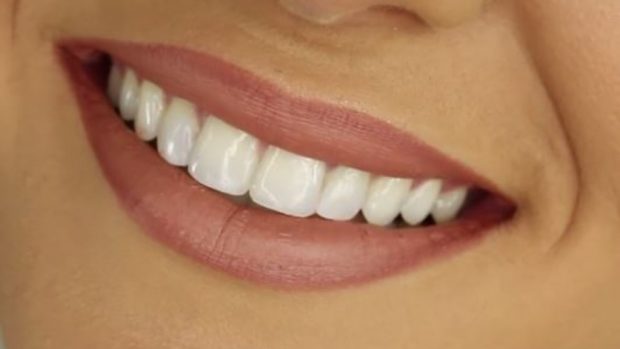 4 tratamientos de cosmética dental a tener en cuenta 