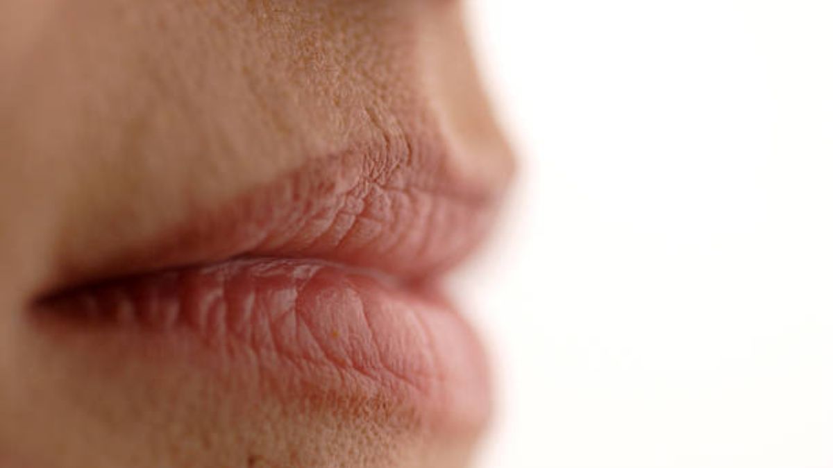 Elimina las arrugas de los labios con remedios naturales