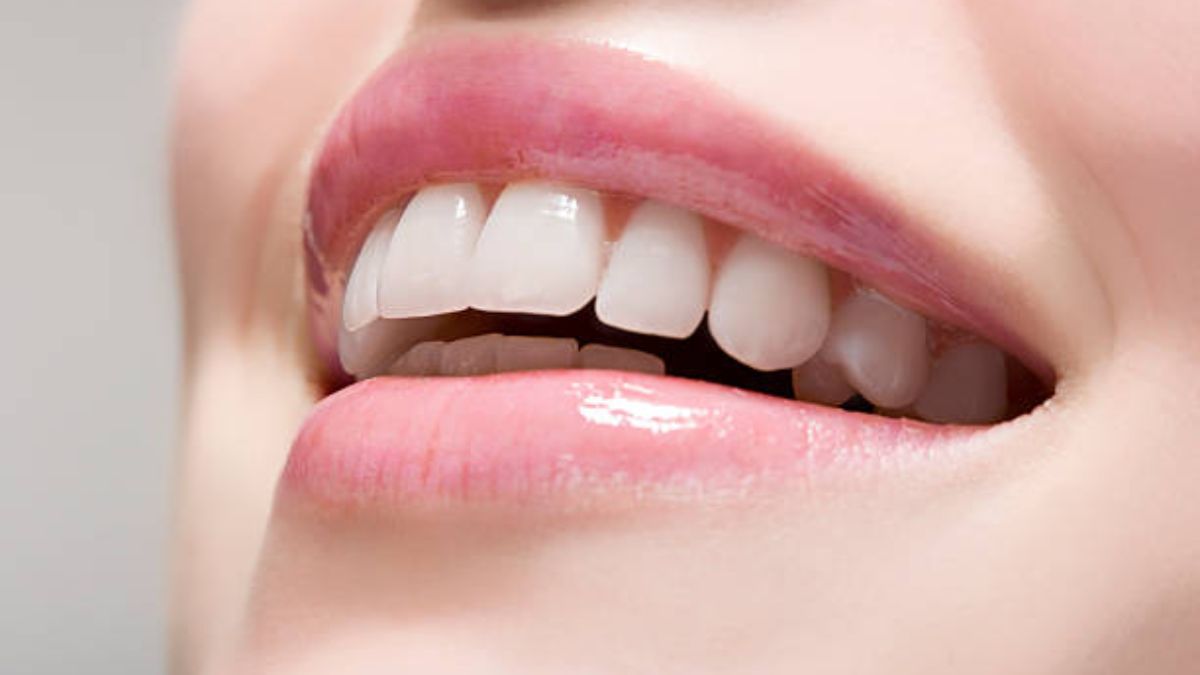 Remedios naturales para tener unos dientes blancos y brillantes