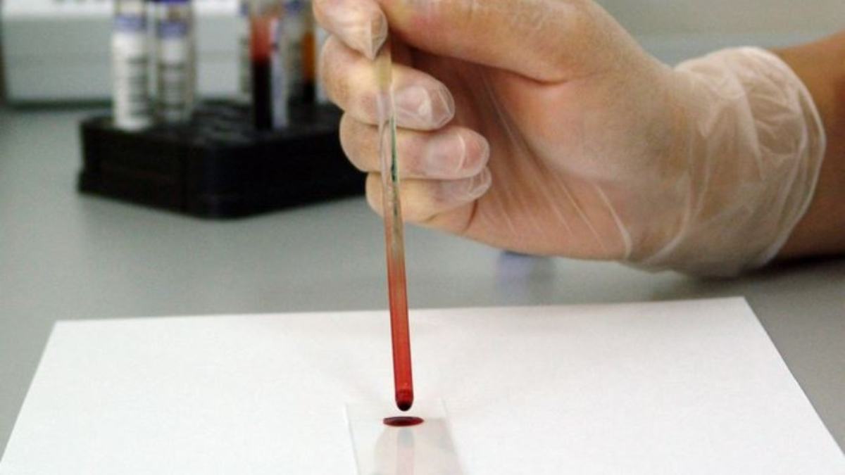 La inusual sangre dorada, el grupo sanguíneo que solo tienen un total de 40 personas
