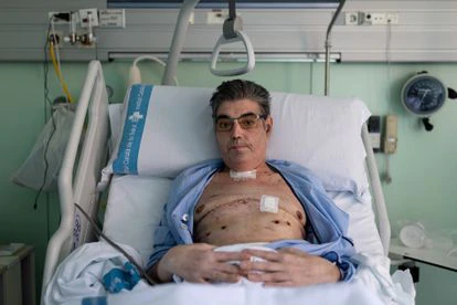 En la imagen, Soriano muestra las cicatrices tras el trasplante.