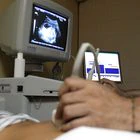 DVD 453 (19-08-10) Reportaje sobre la interrupción del embarazo (aborto), en la Clínica Dator. © Luis Sevillano