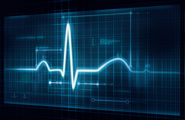 Cardiomatics gana $ 3.2 millones por su inteligencia artificial de lectura de ECG