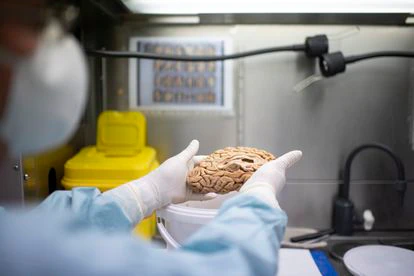 Una investigadora sostiene uno de los cerebros del banco de la fundación Cien el pasado 22 de junio.