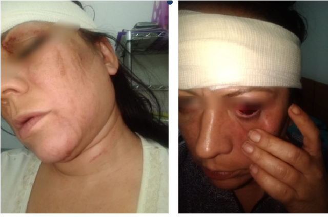 Policía golpea salvajemente a su esposa, detenido por intento de feminicidio, en Querétaro