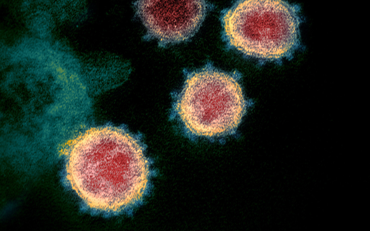 Variante altamente mutada del virus SARS-CoV-2 genera preocupación internacional