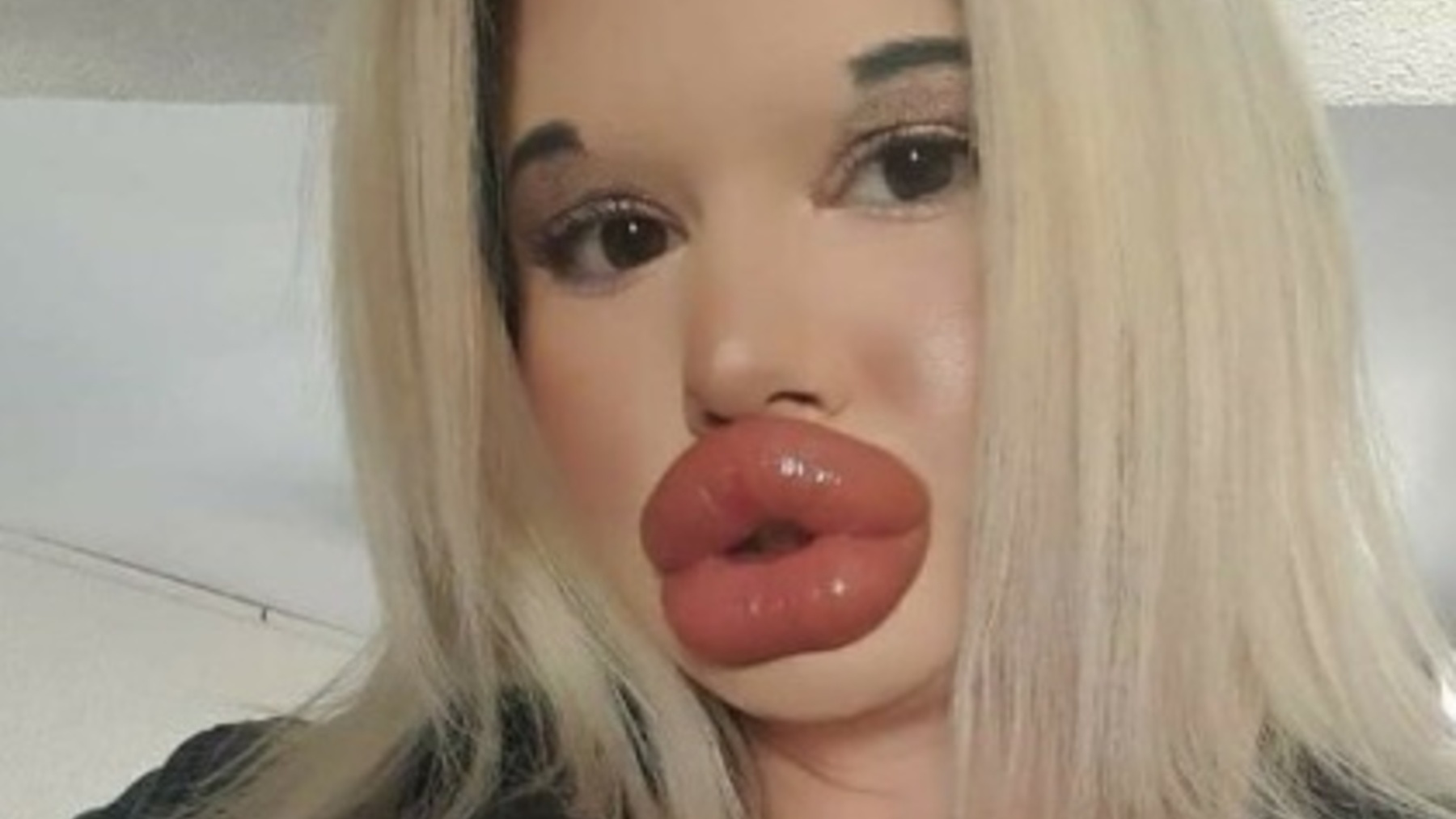 La mujer con los labios más grandes del mundo se ha gastado casi 6.000 euros en aumentarlos