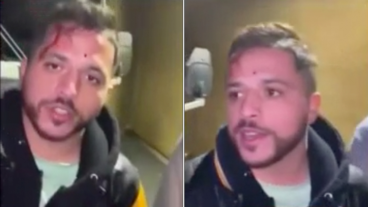 Con rostro ensangrentado: cantante Jesús Mendoza recibe brutal ataque antes de concierto en California