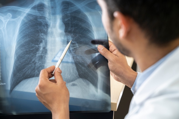 Endeavour BioMedicines recauda $ 62 millones para combatir la enfermedad pulmonar