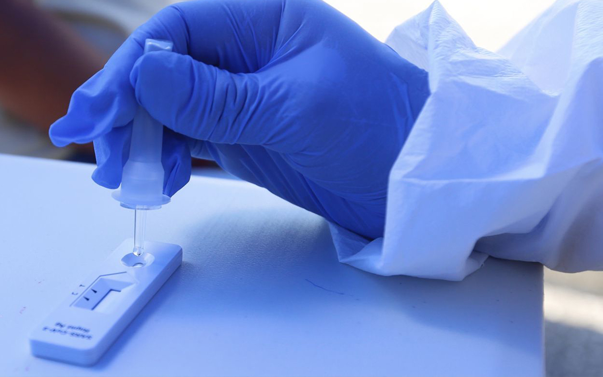 Estudian en Alemania pruebas rápidas para detectar la variante ómicron