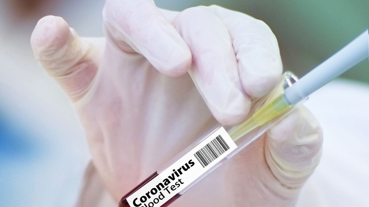 ¿Cómo será el futuro del coronavirus cuando acabe la pandemia?