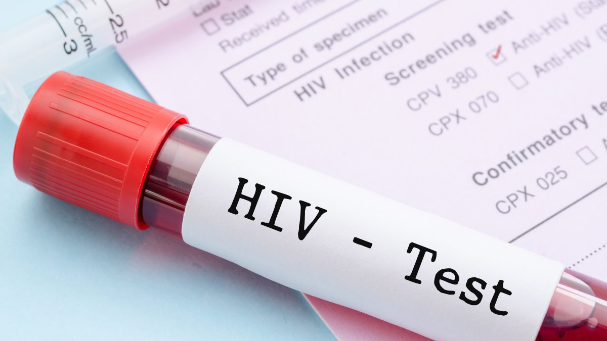 Científicos posiblemente han curado el VIH en una mujer por primera vez