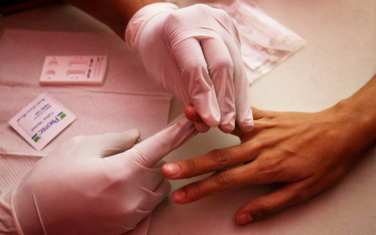 Descubren variante de VIH más transmisible y riesgosa | Estudio