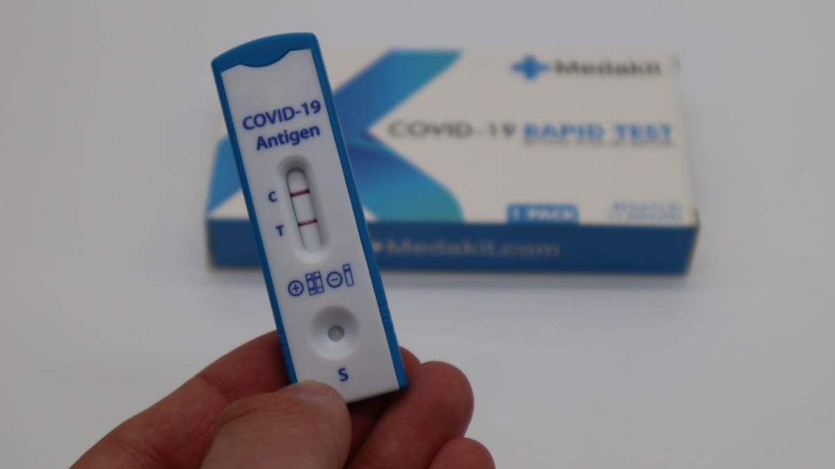 ¿Qué son los test de antígenos? ¿Son igual de fiables que una PCR?