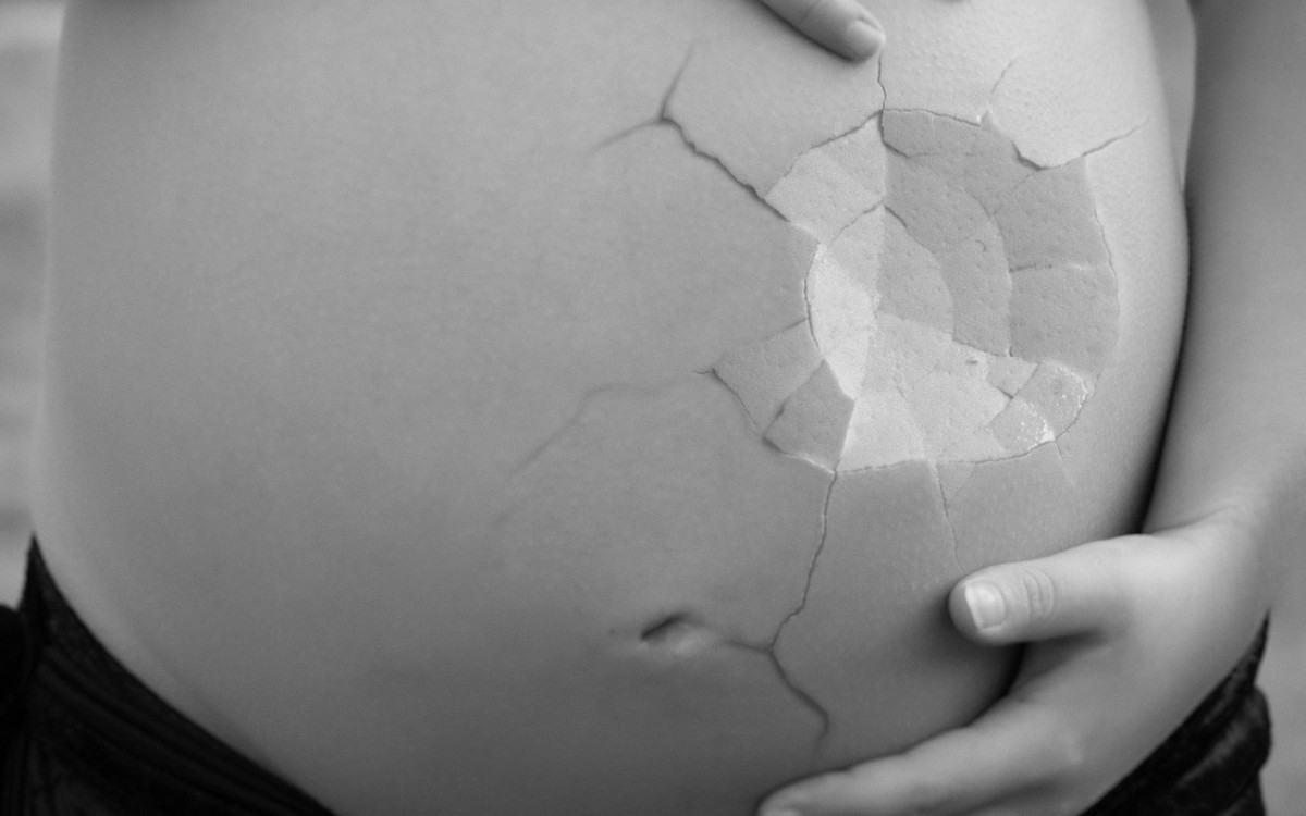 Cada muerte o daño por un aborto inseguro se puede prevenir fácilmente: OMS