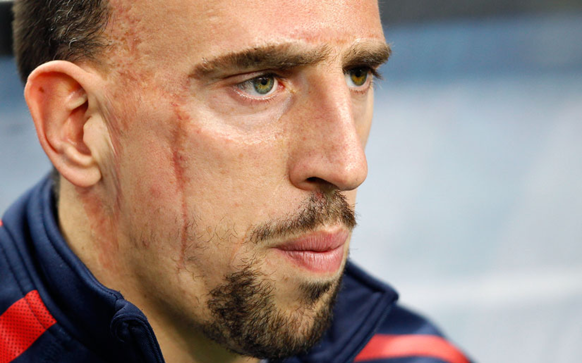 Salernitana multará a Ribéry tras su accidente de tránsito | Video