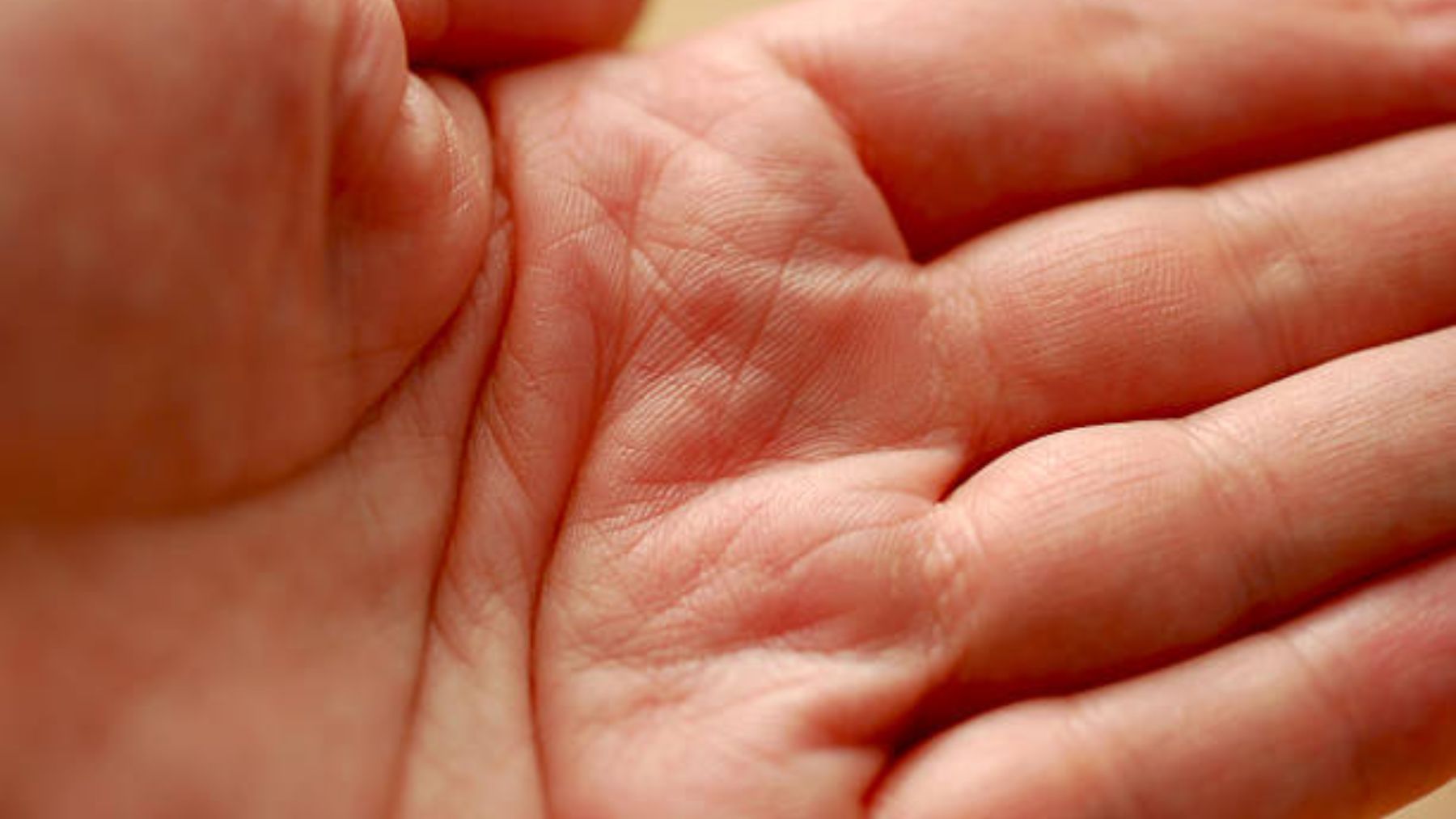 Esta marca en tu mano indica si tendrás algún problema de salud