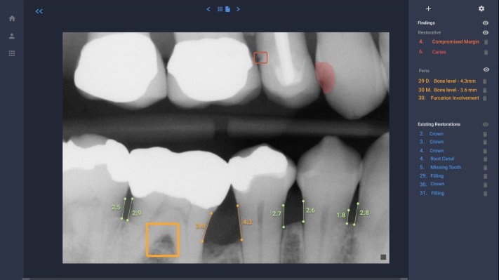 Overjet hunde sus dientes en otra ronda de capital para su tecnología de IA dental