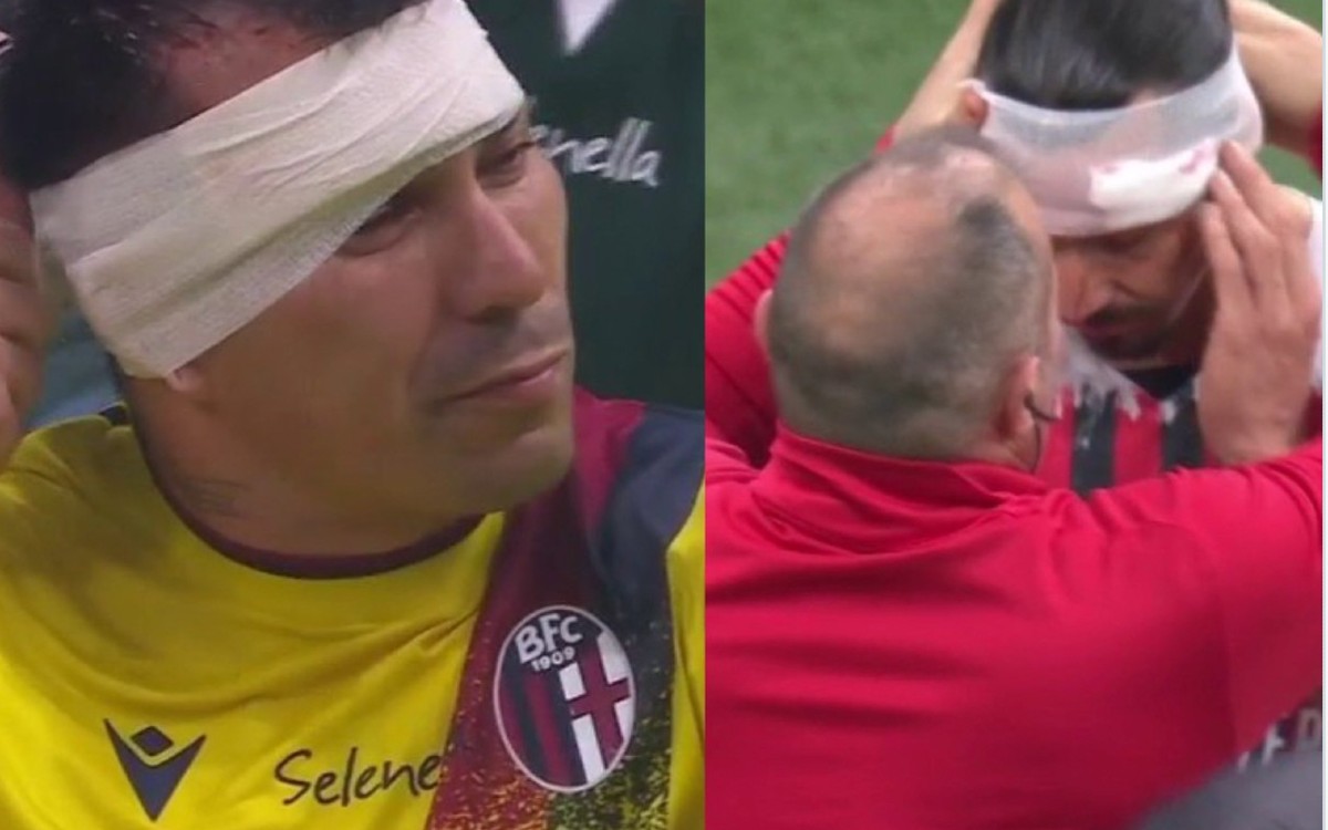 Terminan Zlatan Ibrahimovic y Gary Medel heridos, vendados y muy enojados | Video