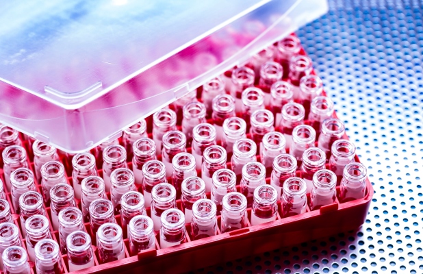Thriva recauda £ 4 millones de Target en una era en la que las pruebas de sangre en el hogar son más cruciales que nunca