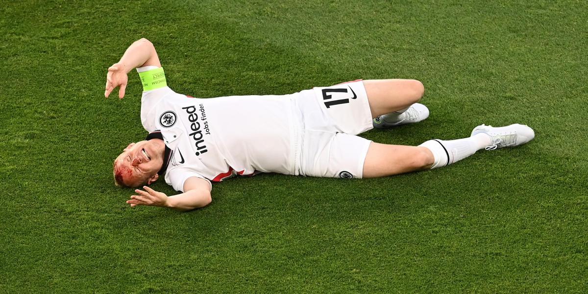 El capitán del Eintracht, ensangrentado por una dura entrada