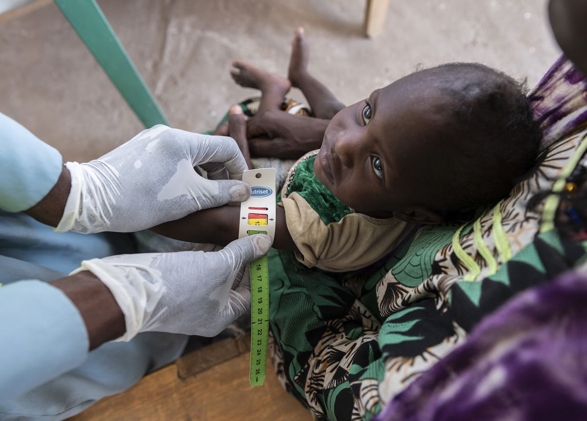 La malnutrición se ceba con los más pobres de África