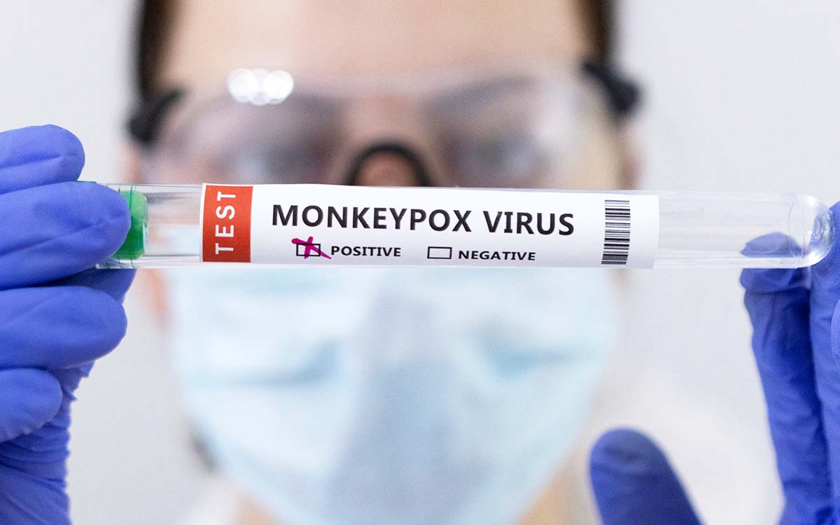 OMS: viruela del mono ya llegó a 42 países y suman 2,103 casos confirmados