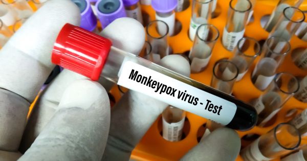 Viruela del mono: “No hay necesidad inmediata de vacunación masiva”, sostienen desde la OMS
