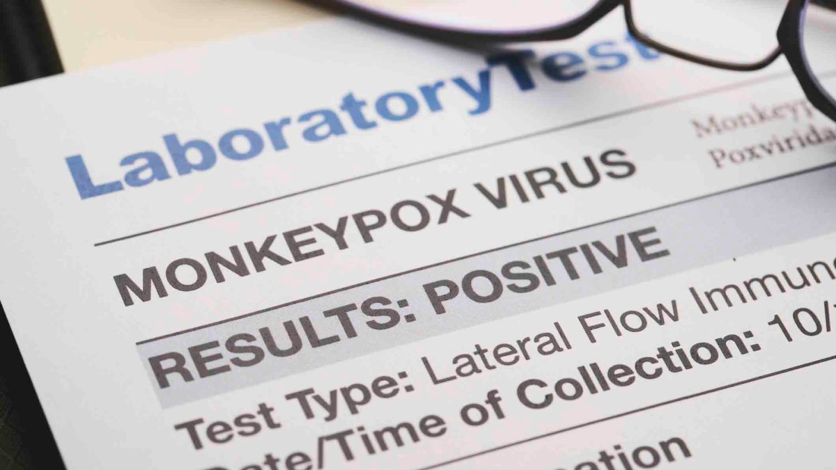 Viruela del mono: médicos consideran vacunas para personas que “tienen múltiples parejas”