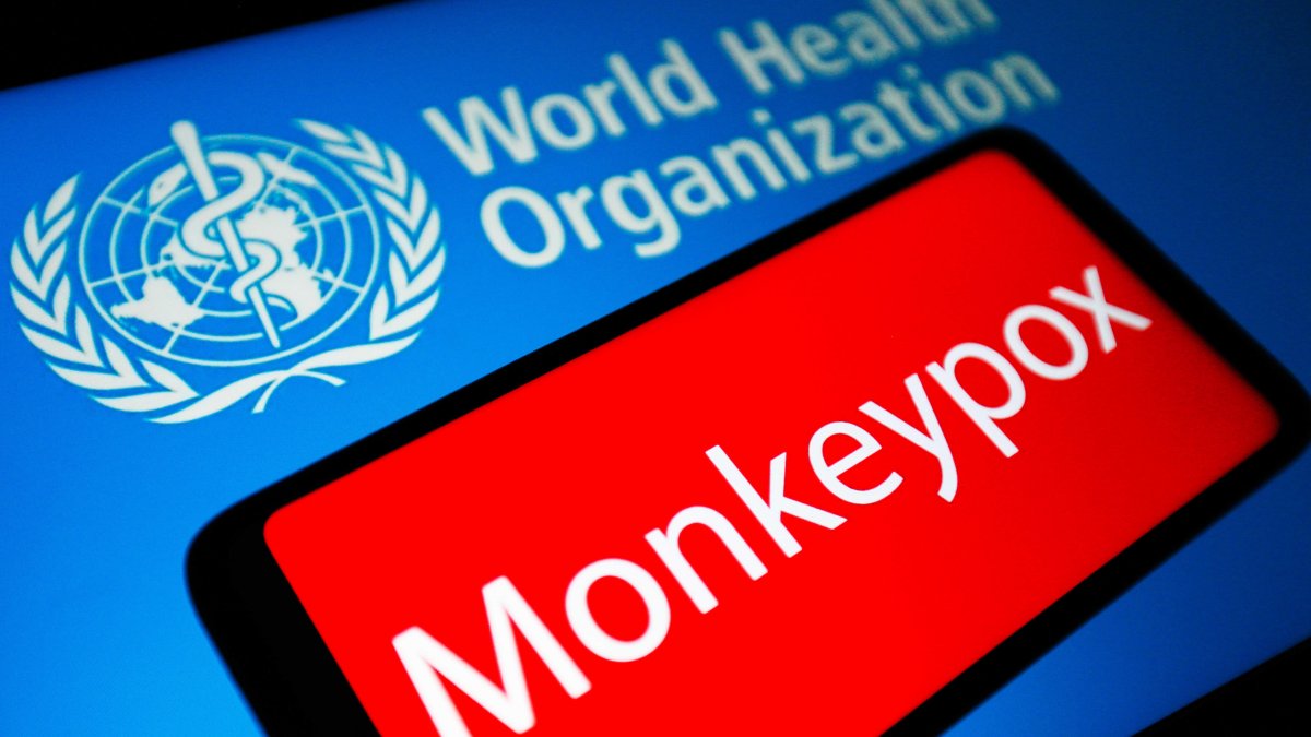 Viruela del mono: EEUU anuncia nuevas medidas contra brote