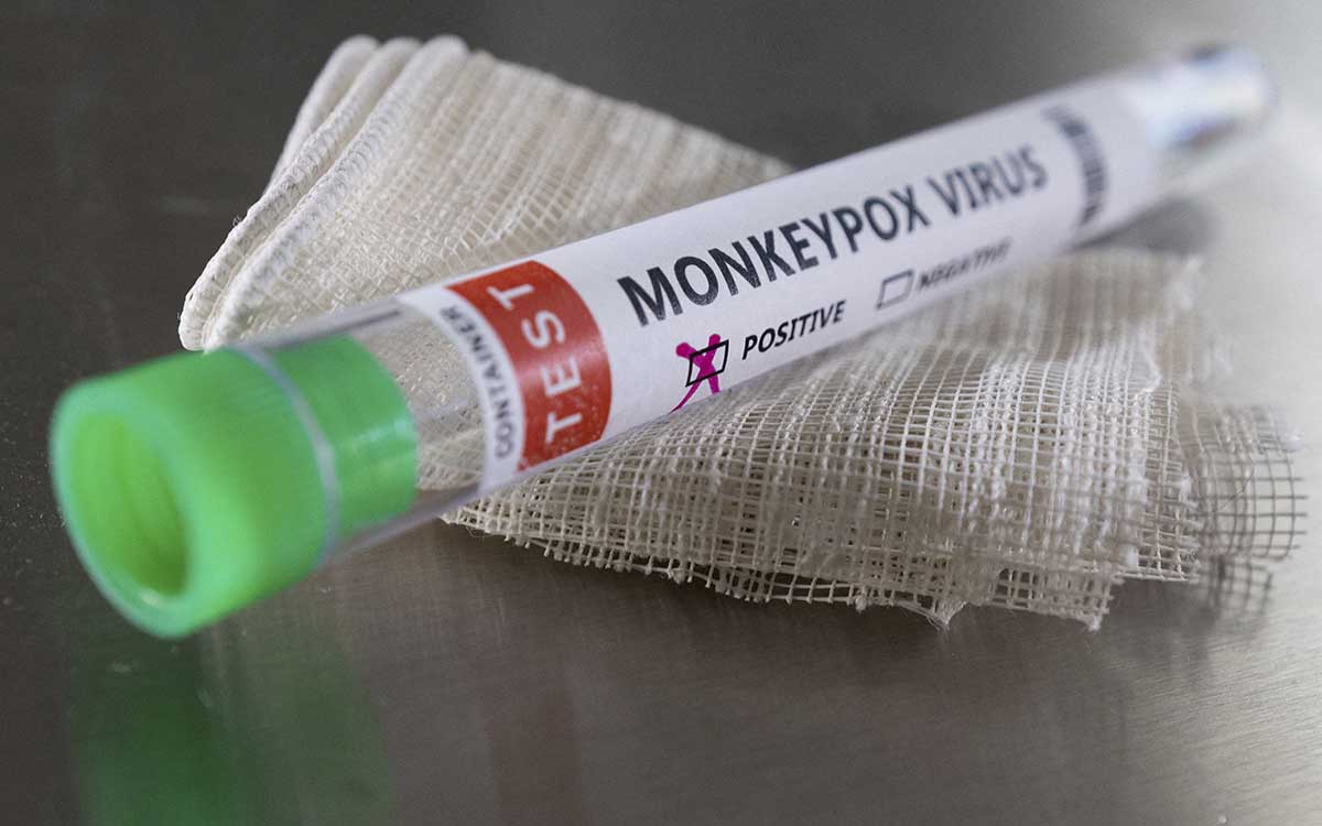 Confirman el segundo caso de viruela del mono en la Ciudad de México